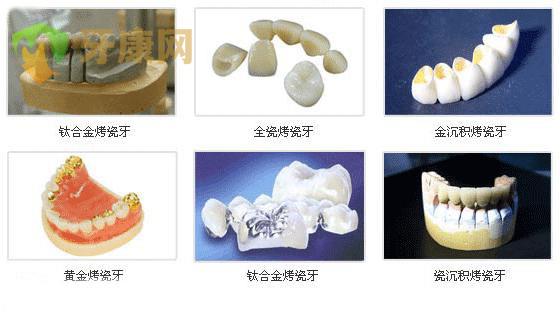 如何矫正瓜子牙,瓜子牙矫正需要多少钱