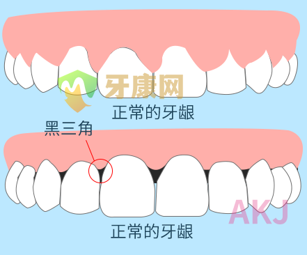 牙缝大