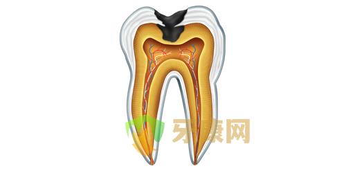 杀牙神经的坏处