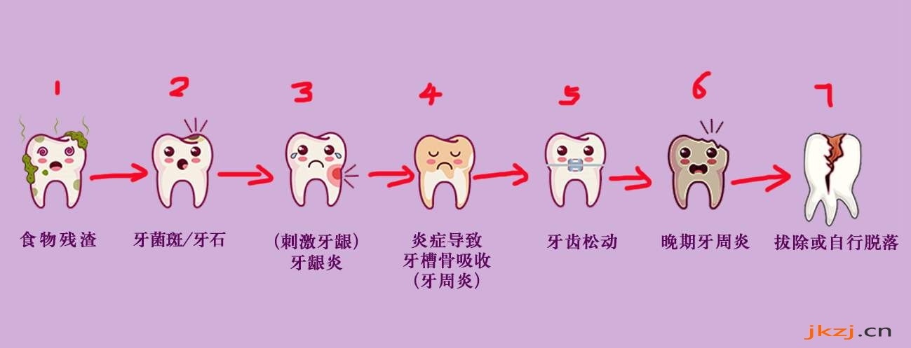 无论有没有好好刷牙，都需要洗牙