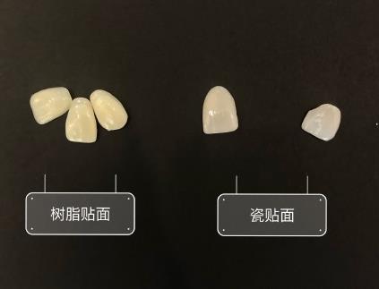 牙齿贴面的两种材料