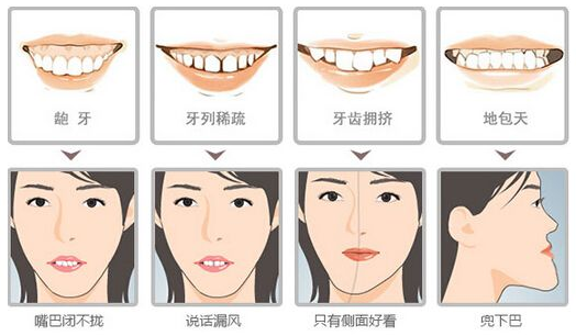 骨性龅牙和非骨性龅牙