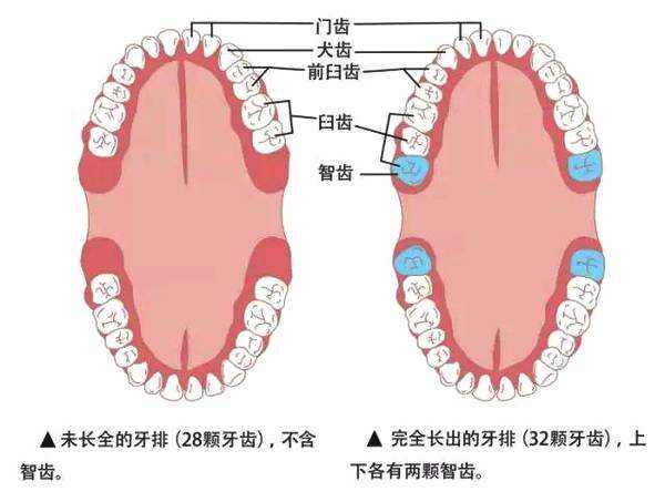 正常的智齿生长位置图片