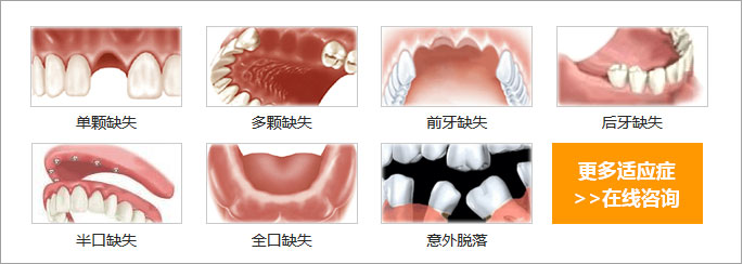 深圳半口牙缺失修复要多少钱