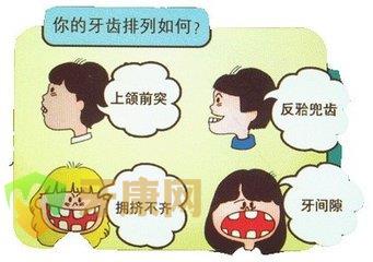 儿童牙齿矫正价格