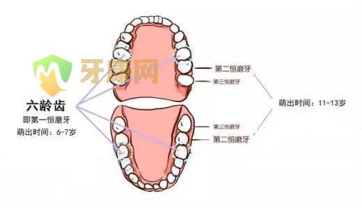 窝沟封闭哪些牙齿哪个年龄做好