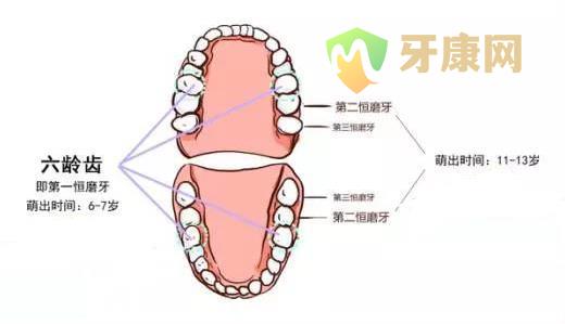 窝沟封闭