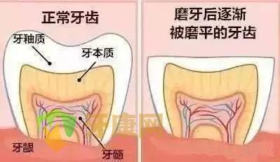 磨牙的危害