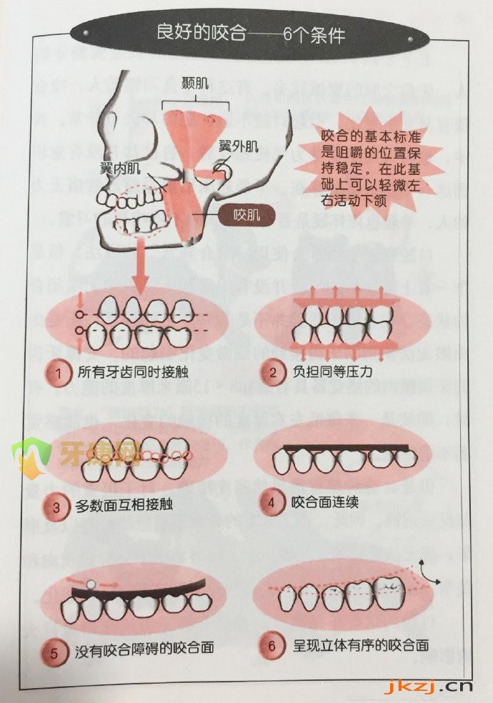 标准咬合6个条件